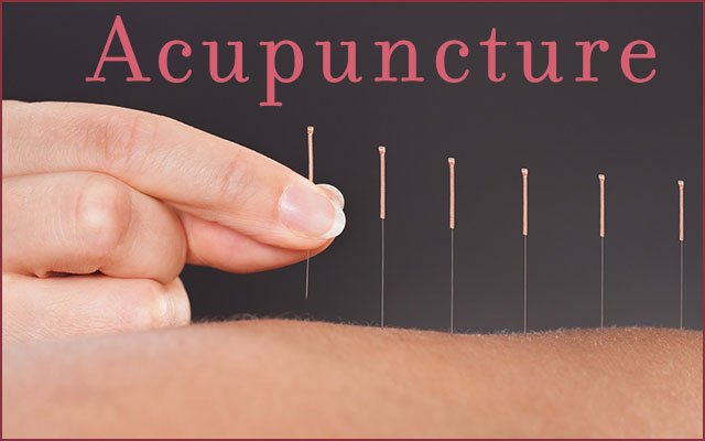Can Acupuncture Solve Your Pain Problem?