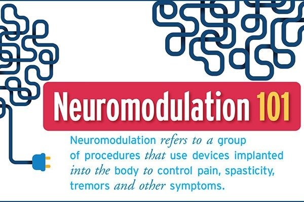 Neuromodulation 101
