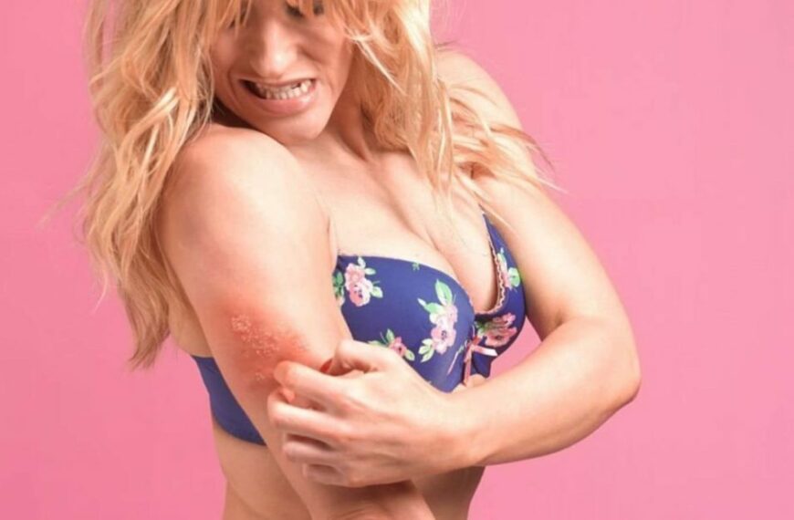 What Are Shingles? Different Methods To Prevent Shingles!