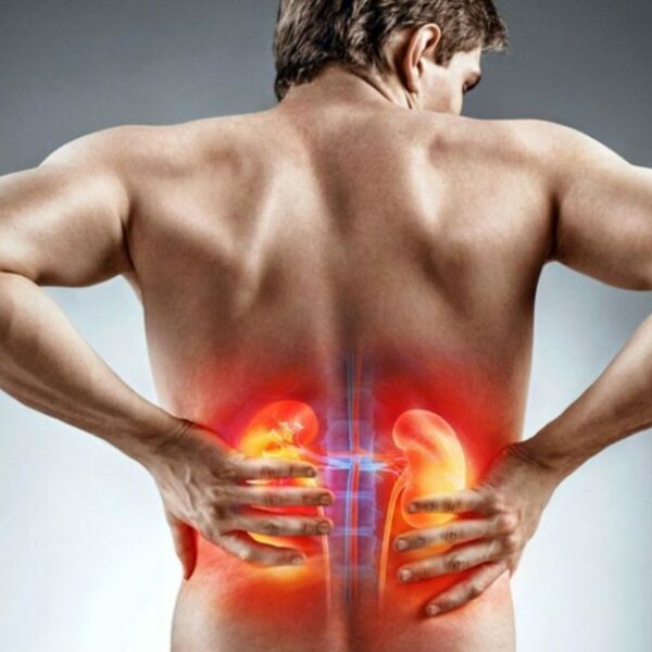 Kidney Pain: Causes, Symptoms, Diagnosis, And Treatments