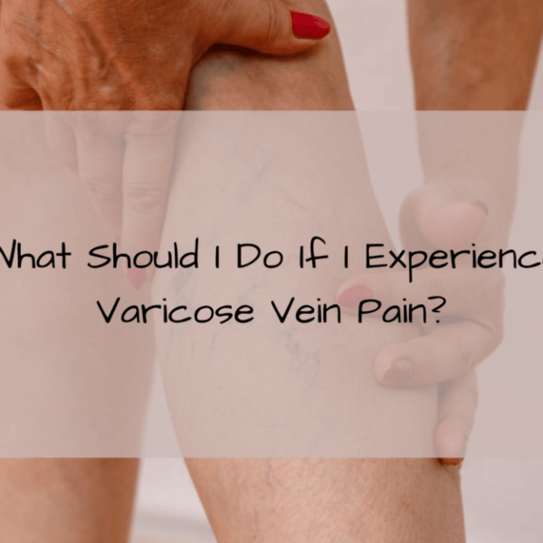 What Should I Do If I Experience Varicose Vein Pain?