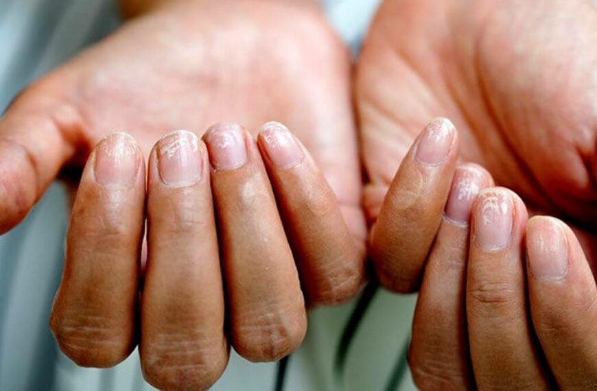 7 Possible Causes Of Fingernail Pain – Discover Possible Causes!