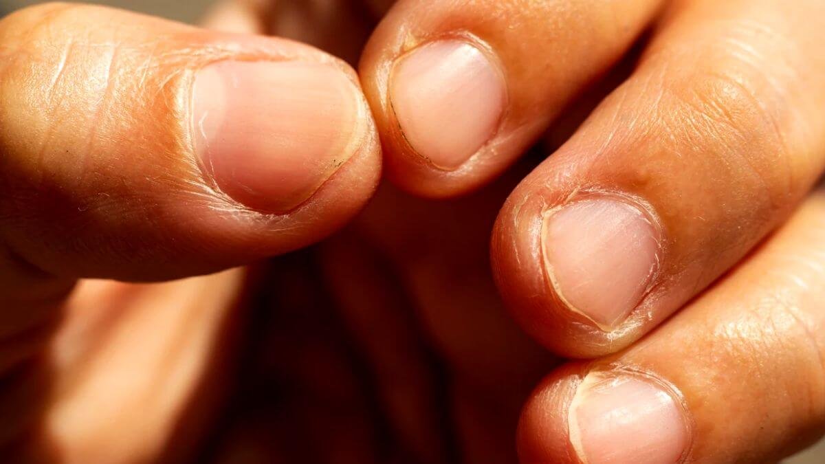 Fingernail Pain