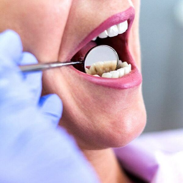 Can Wisdom Teeth Cause Neck Pain? Is There Any Connection?