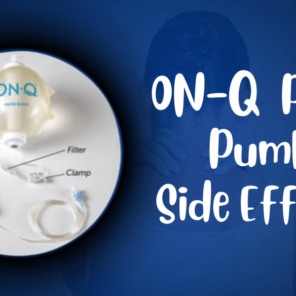 ON-Q Pain Pump Side Effects – Working And Its Effects On The Body!