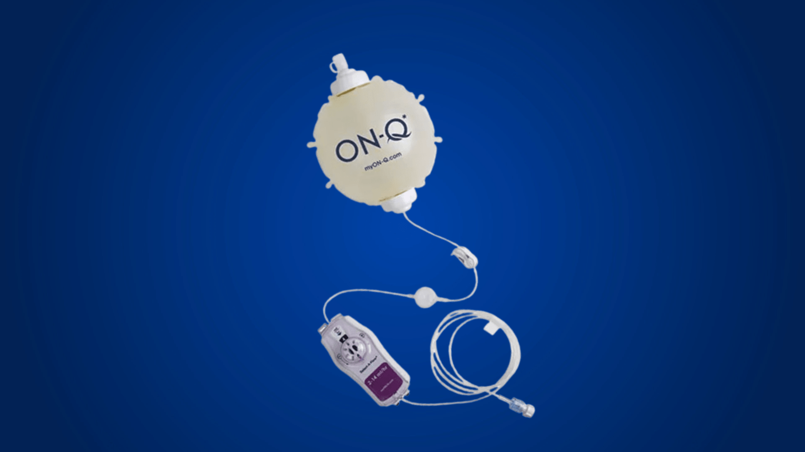 ON-Q Pain Pump Side Effects