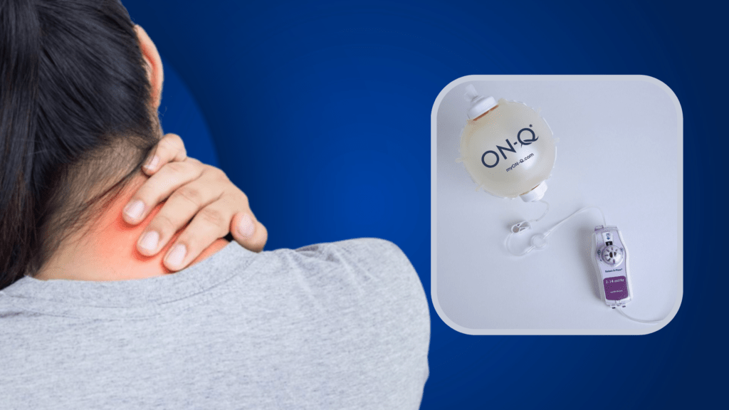 ON-Q Pain Pump Uses