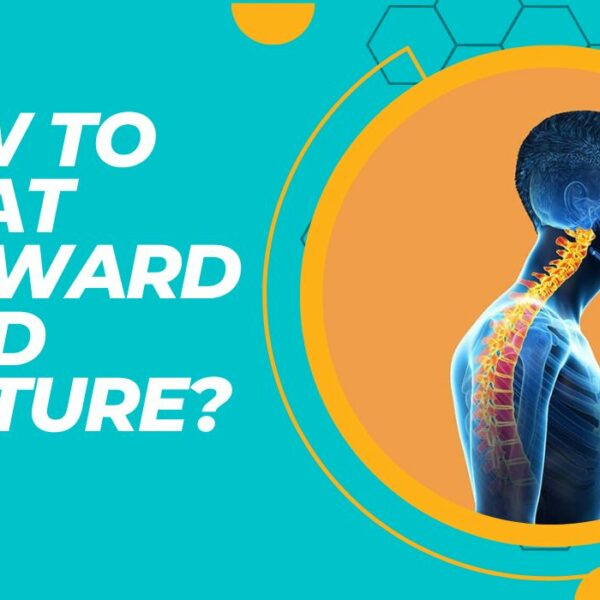 How To Treat Forward Head Posture