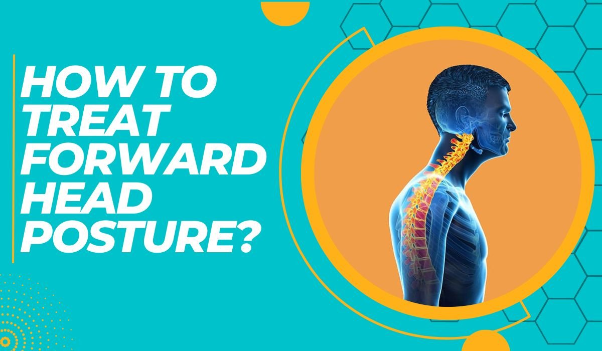 How To Treat Forward Head Posture