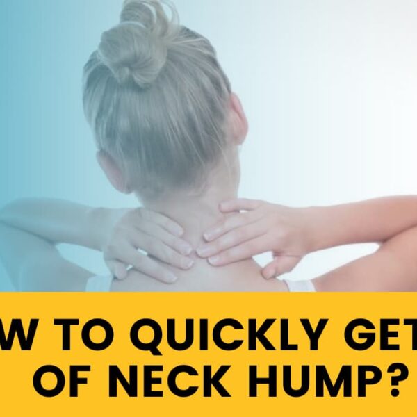 How To Quickly Get Rid Of Neck Hump? – Some Of The Proven Methods To Follow!