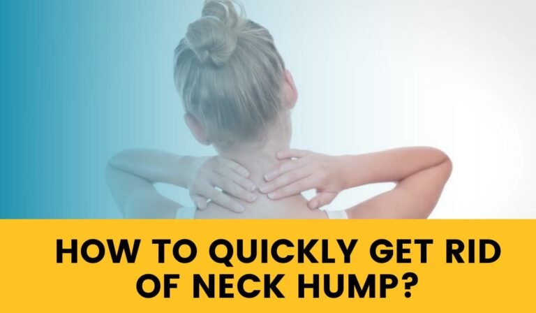 How To Quickly Get Rid Of Neck Hump? – Some Of The Proven Methods To Follow!